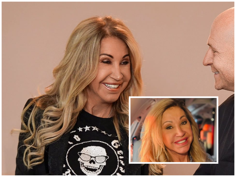 Carmen Geiss Facelift